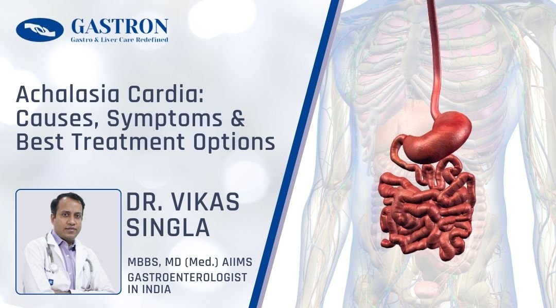 Achalasia Cardia Causes, Symptoms & Best Treatment Options