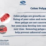 Colon Polyps