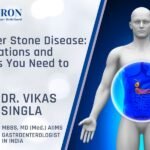 Gallbladder Stone Disease 5 Complications and Symptoms You Need to Watch For