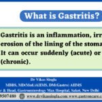 Gastritis