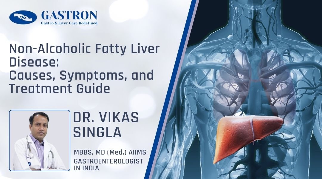 Non-Alcoholic Fatty Liver Disease Causes, Symptoms, and Treatment Guide