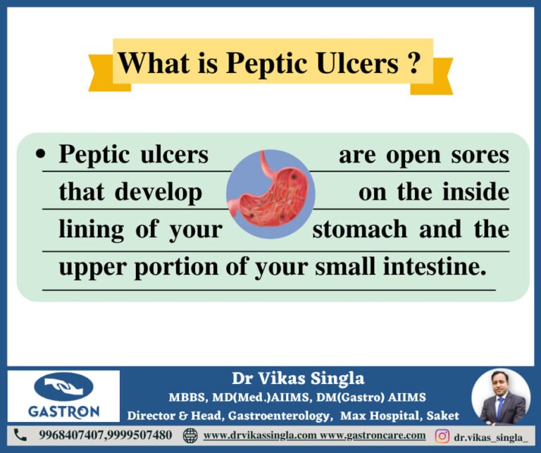 Peptic Ulcer Causes Symptoms And Tips Dr Vikas Singla