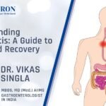 Understanding Esophagitis A Guide to Relief and Recovery