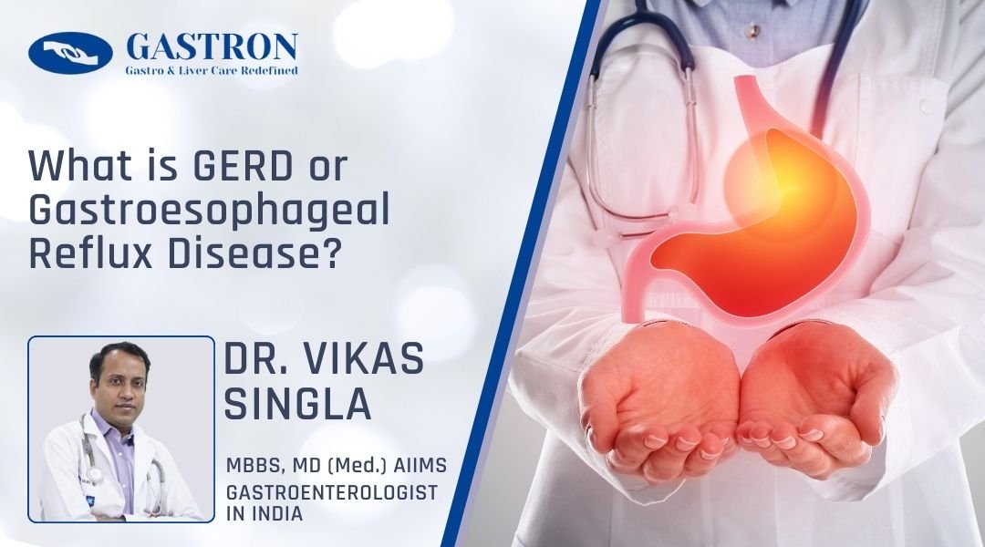 What is GERD or Gastroesophageal Reflux Disease