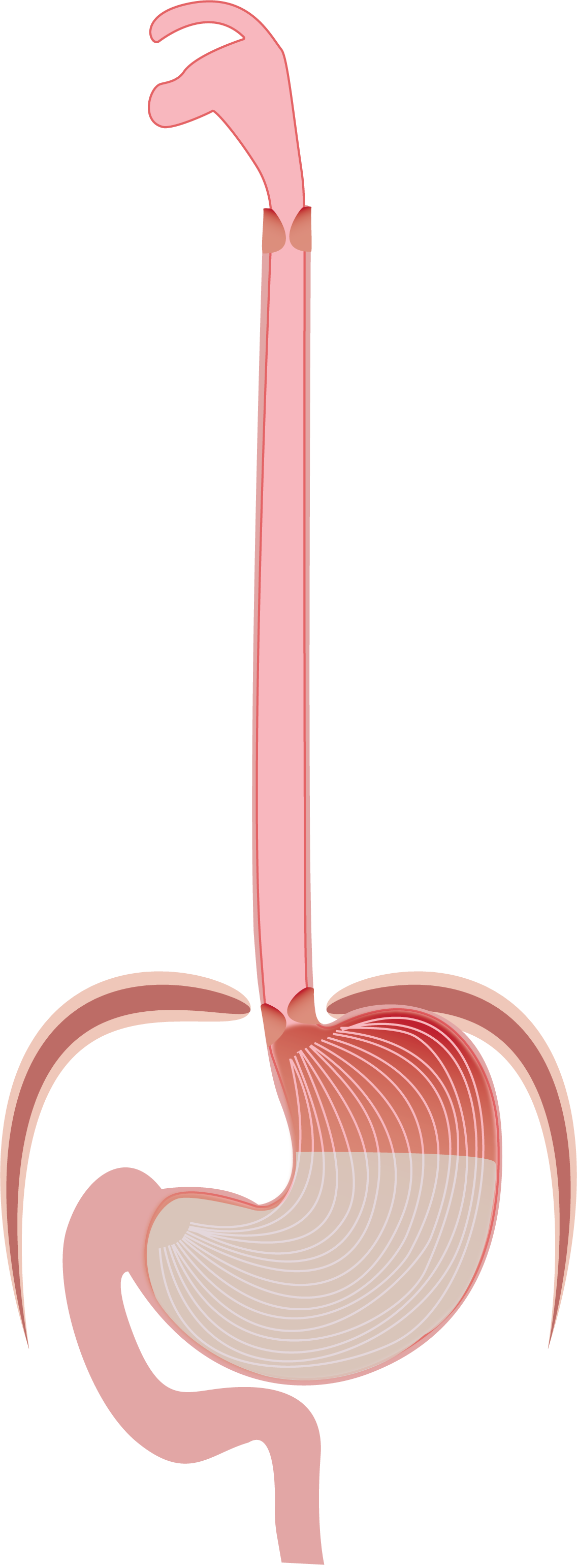 Esophageal Stricture: Causes, Symptoms, and Treatment - Dr. Vikas Singla