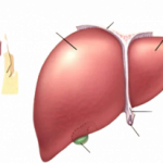 liver disease